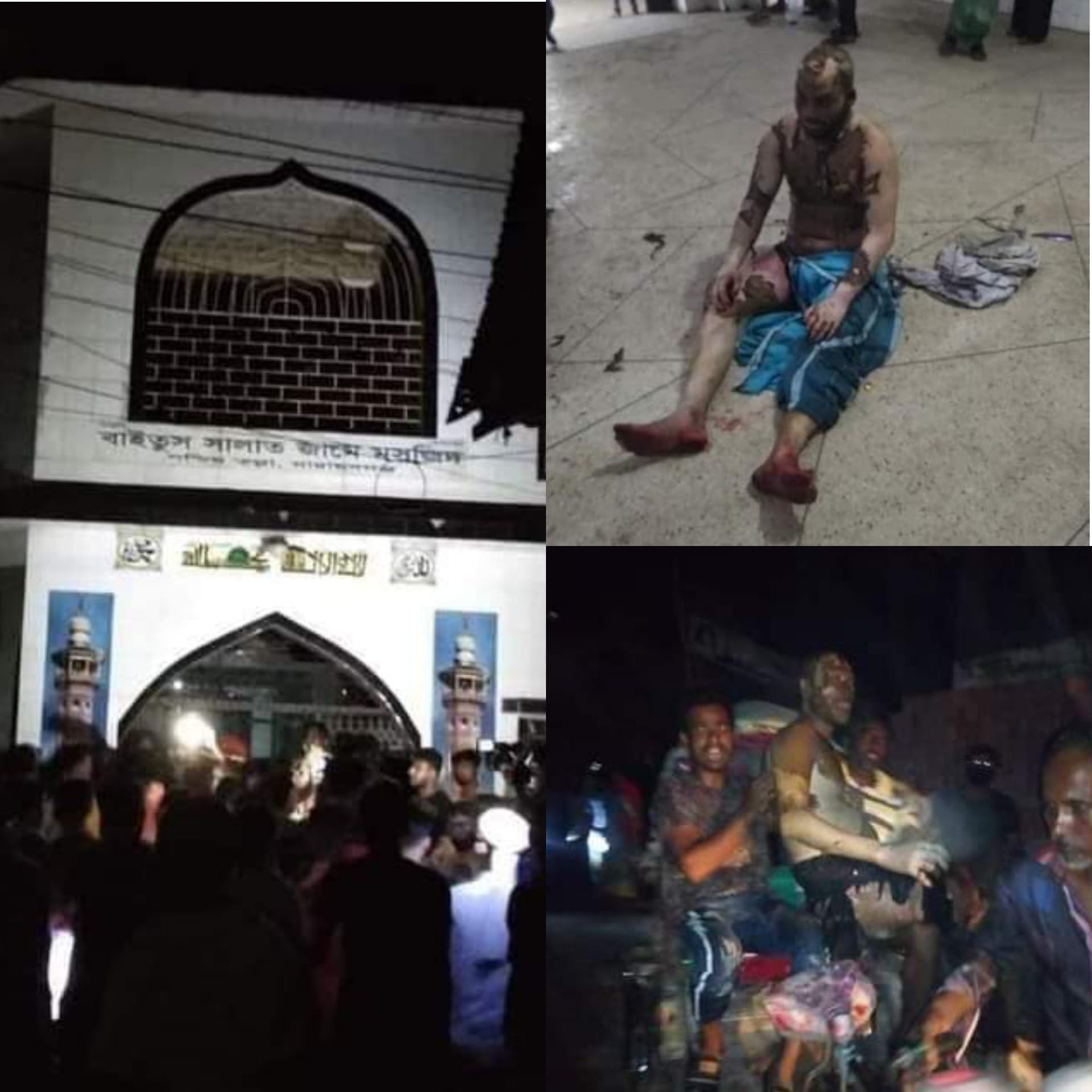 মসজিদে এসি বিষ্ফোরণঃ আহতদের উন্নত চিকিৎসা চলছে মসজিদে এসি বিষ্ফোরণঃ আহতদের উন্নত চিকিৎসা চলছে
