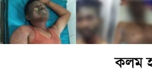 চট্টগ্রামে শিপ ইয়ার্ডে গ্যাস বিস্ফোরণে ৩ শ্রমিক দগ্ধ চট্টগ্রামে শিপ ইয়ার্ডে গ্যাস বিস্ফোরণে ৩ শ্রমিক দগ্ধ