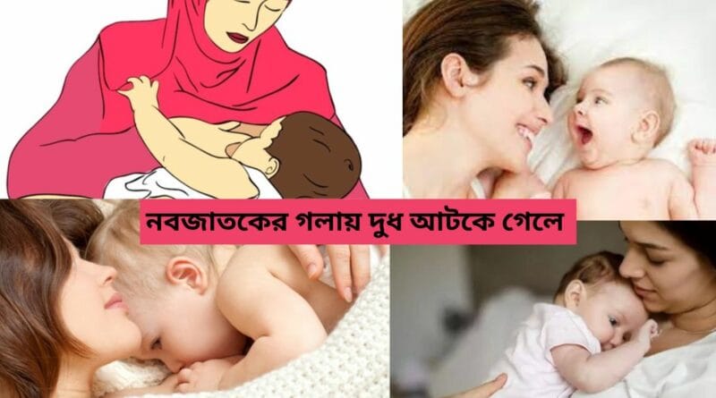 নবজাতকের গলায় দুধ আটকে গেলে